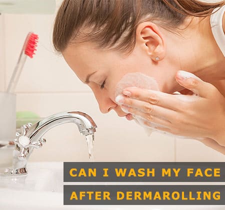 Featured Image of Can I Wash My Face After Dermarolling